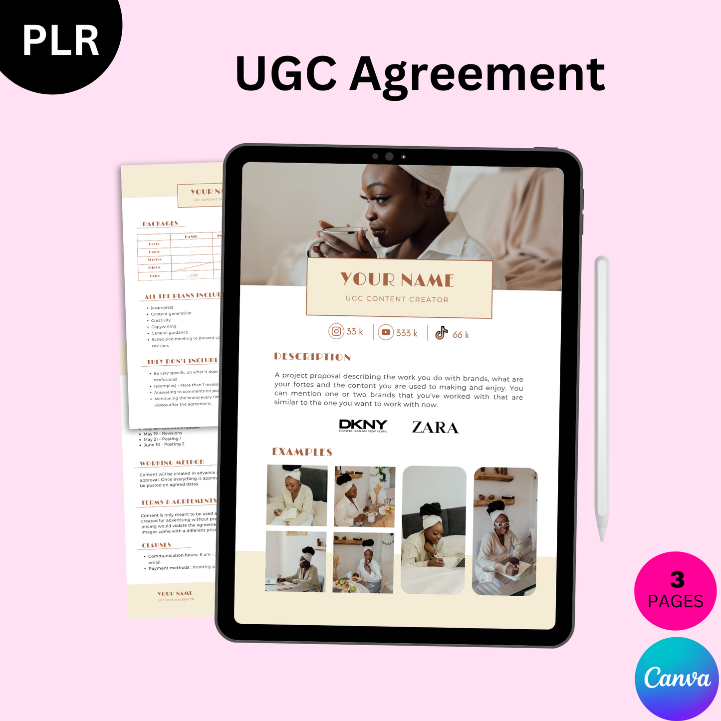 UGC Agreement Contract Template